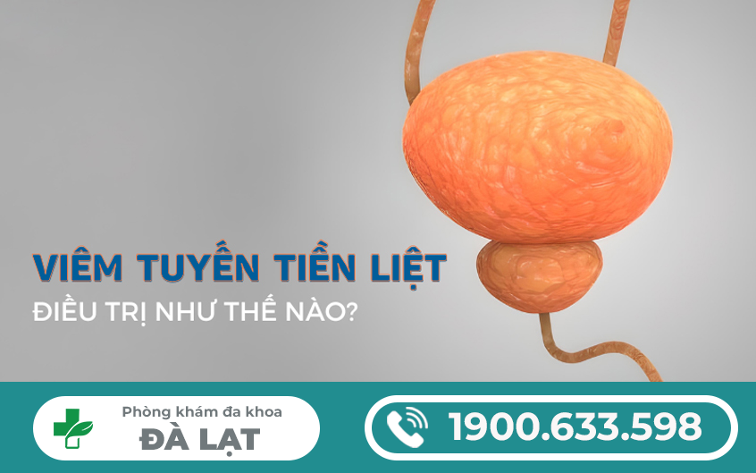 Hình ảnh minh họa